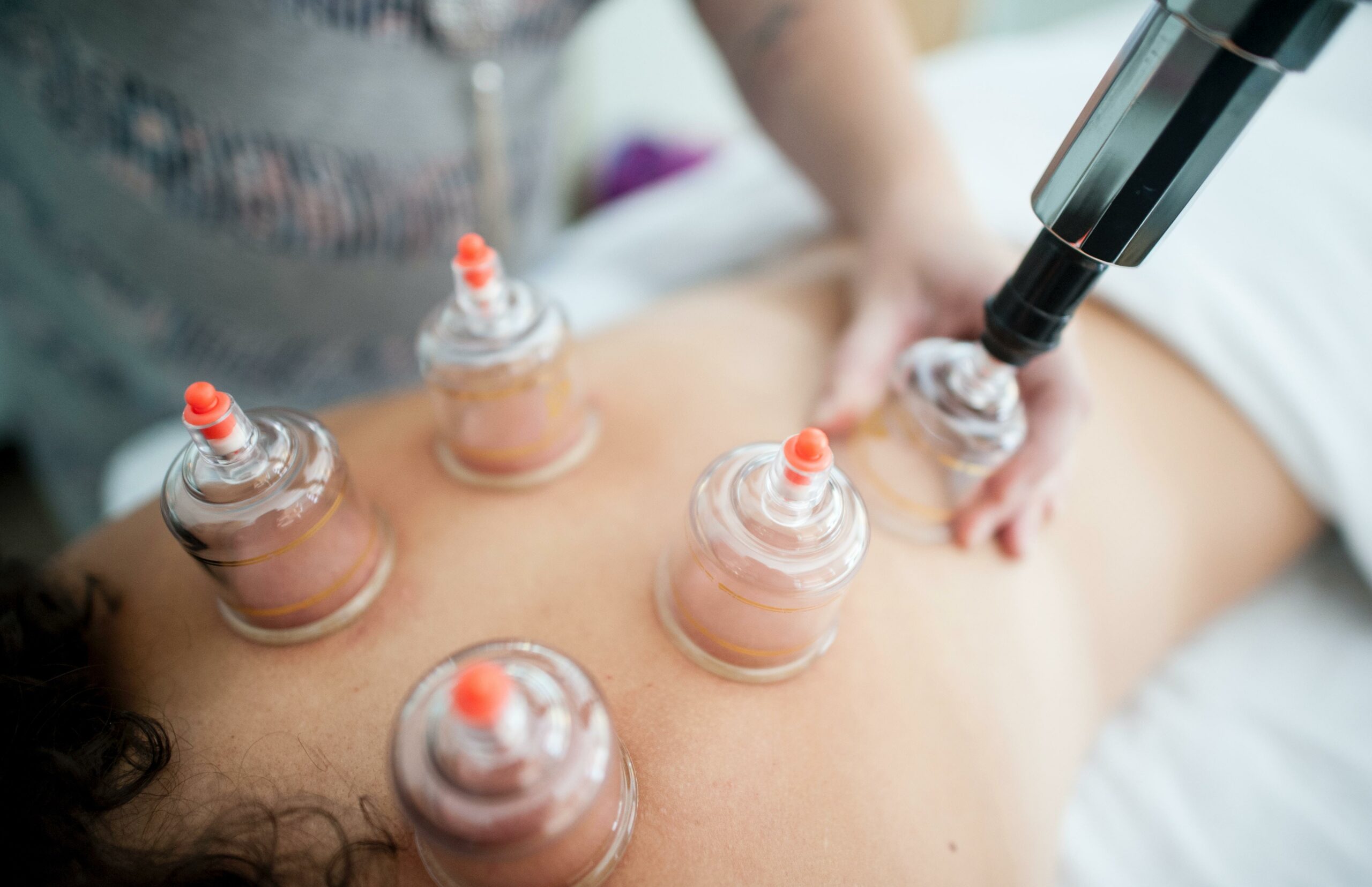 Acupuncture Facts And Statistics
