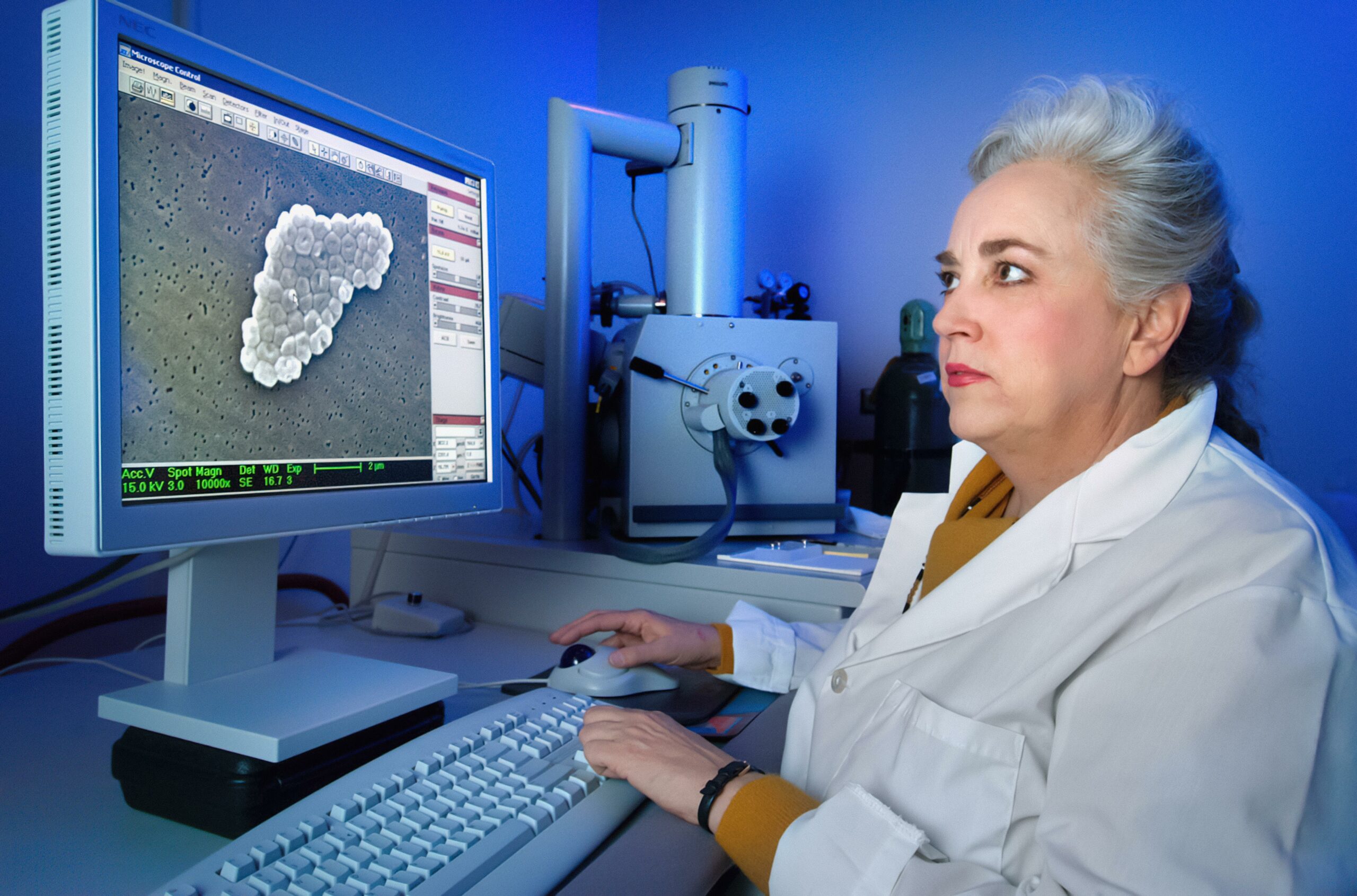 astonishing capabilities and limitations of microscopes