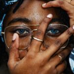 causes-of-atrophic-scars_featured