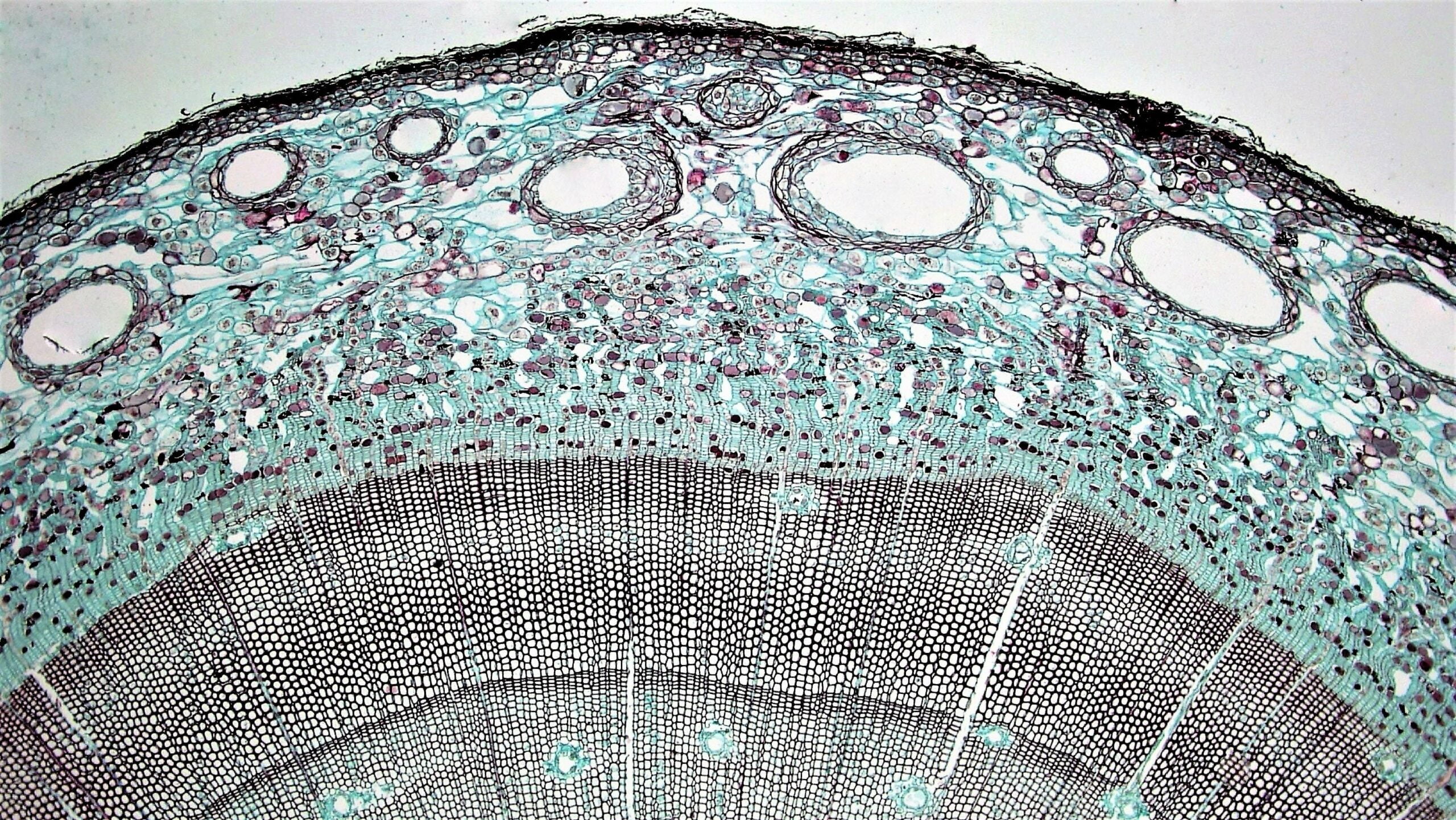 intricate world of microscopy