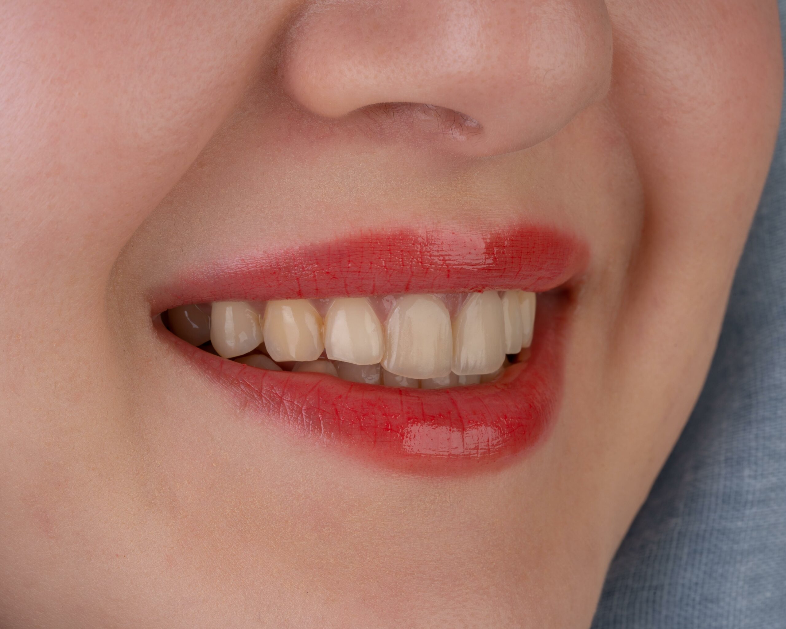 long term untreated tooth decay