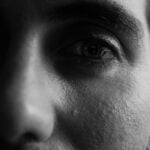 why-is-my-scar-red_featured