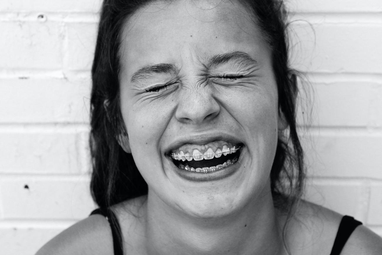Benefits of orthodontics for confidence and oral health