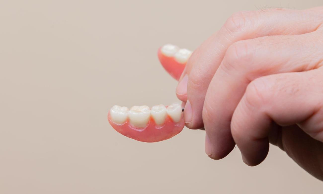 Different categories of orthodontic braces