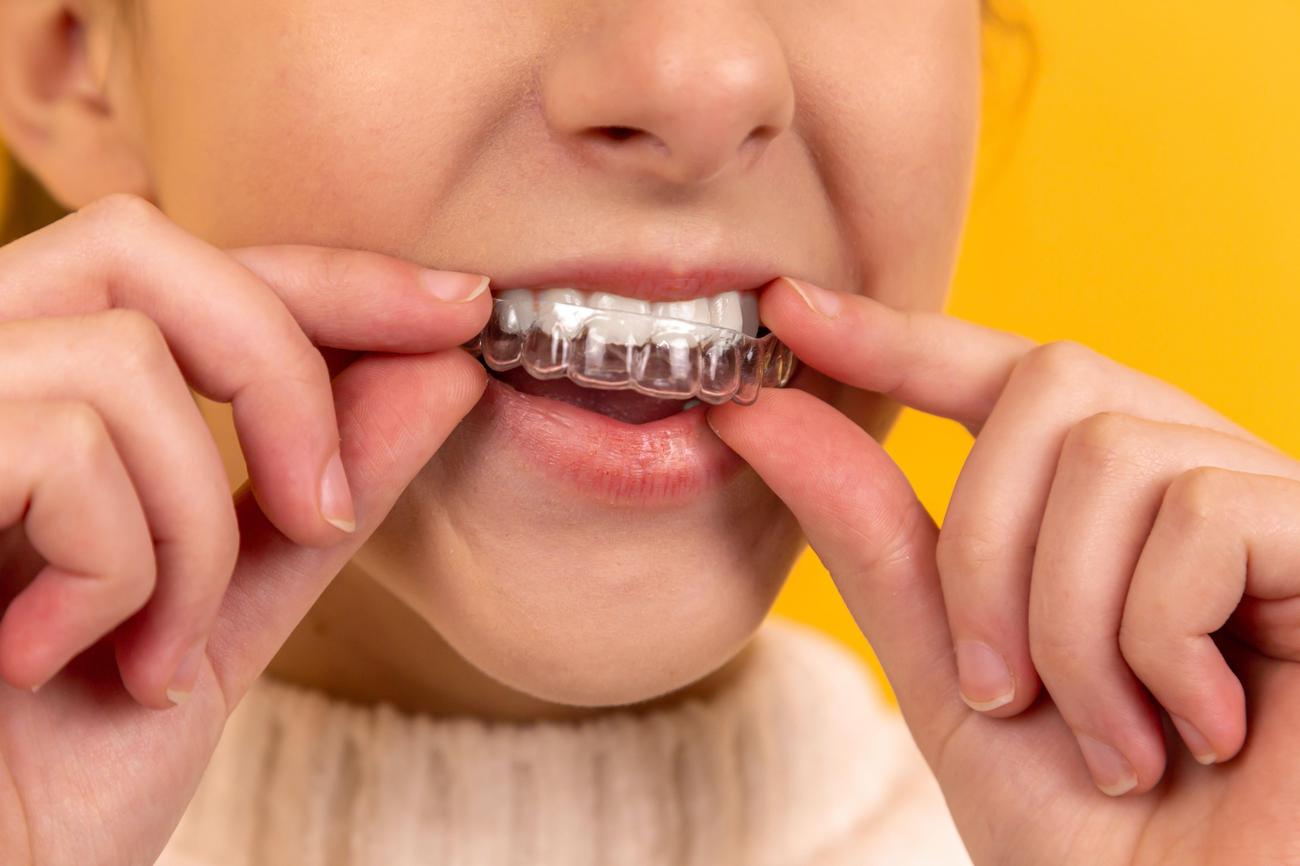 Factors impacting orthodontist salary