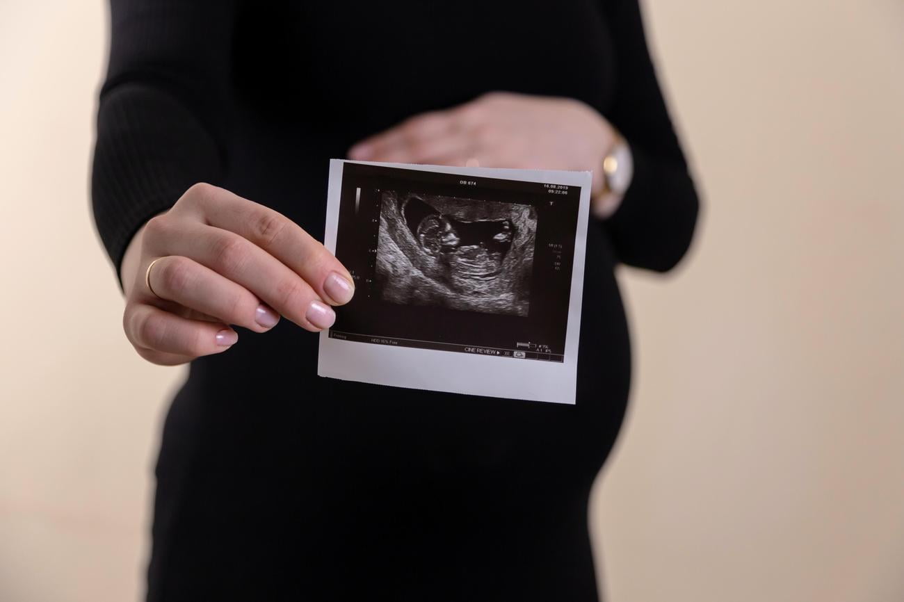 Ultrasound Facts Pregnancy