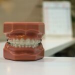 facts-about-braces_featured