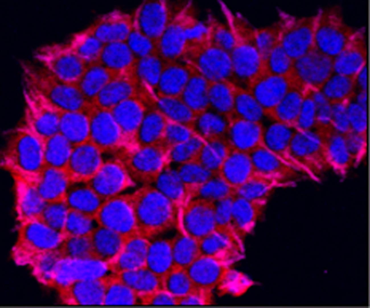 interesting facts about translation during dna replication