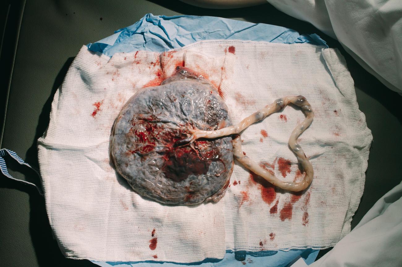 surprising facts about spinal cord trauma