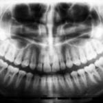 why-do-dentists-kill-themselves_featured