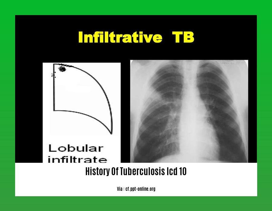 History Of Tuberculosis Icd 10