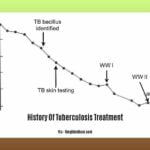 History-Of-Tuberculosis-Treatment_2