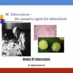 history-of-tuberculosis_2