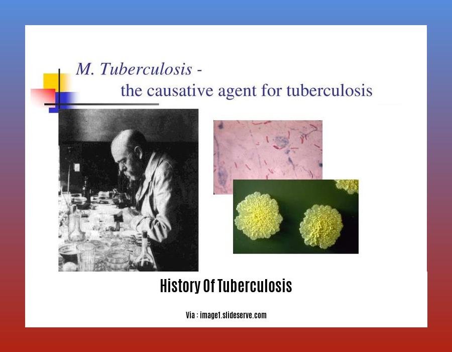 history of tuberculosis 2