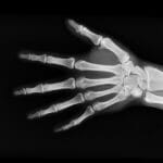 fun-facts-about-radiologist