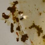 liver_flukes_in_stool_pictures