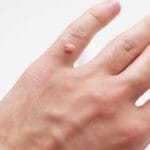 can_frogs_give_you_warts__