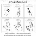 carpal_tunnel_exercises