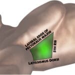 finger_thoracostomy