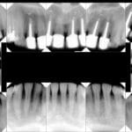 fmx_dental