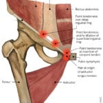 groin_pain_icd_10
