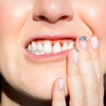 is_gingivitis_contagious