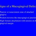 mucogingival_junction