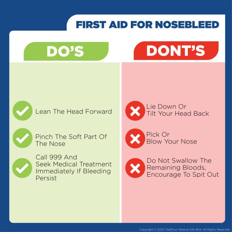 nose bleed icd 10 code