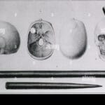 phineas_gage_book