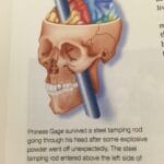 phineas_gage_book