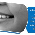 dissolved_stitches_in_mouth