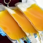 does_donating_plasma_burn_calories