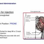 dorsogluteal