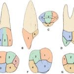 mamelons_in_teeth