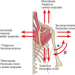 snapping_scapula_syndrome