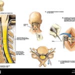 ventral_thecal_sac