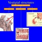 Vestigial structures